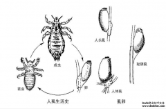 为什么现在还有人得阴虱？ 泉州市正规男科医院