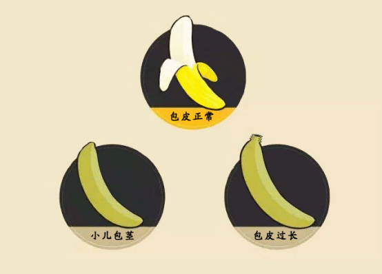 包皮过长影响多大？你确定你已经知道？(图2)