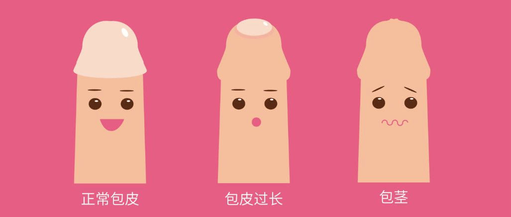 这件事情，99%的男孩子都经历过！(图1)
